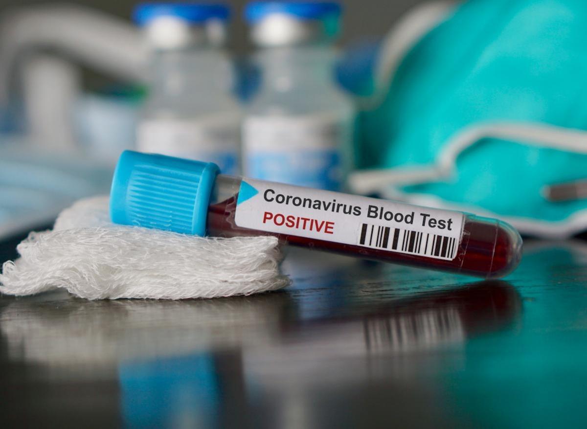 Coronavirus : 70 nouvelles contaminations et 4 nouveaux décès, au total 5 847 personnes infectées et 104 morts